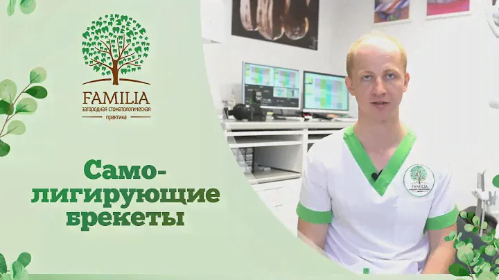 👉 Самолигирующие брекеты